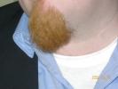 ginger_beard