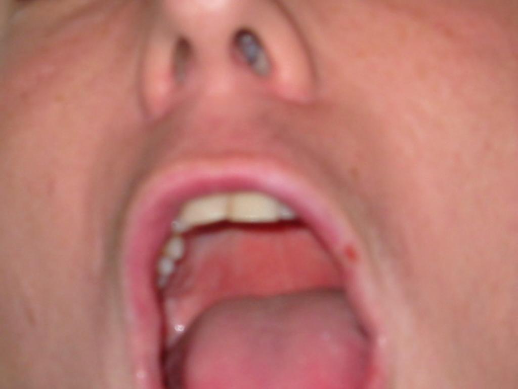 113-1366_IMG
